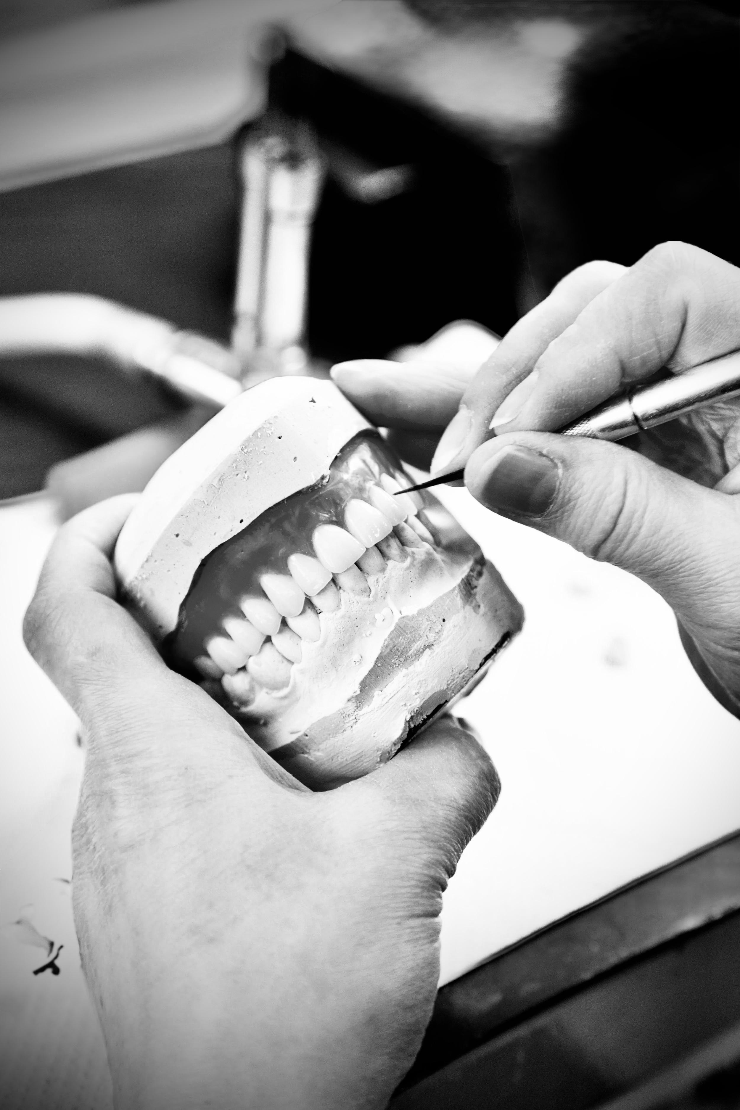 Tre generationer av tandteknik – historisk bild