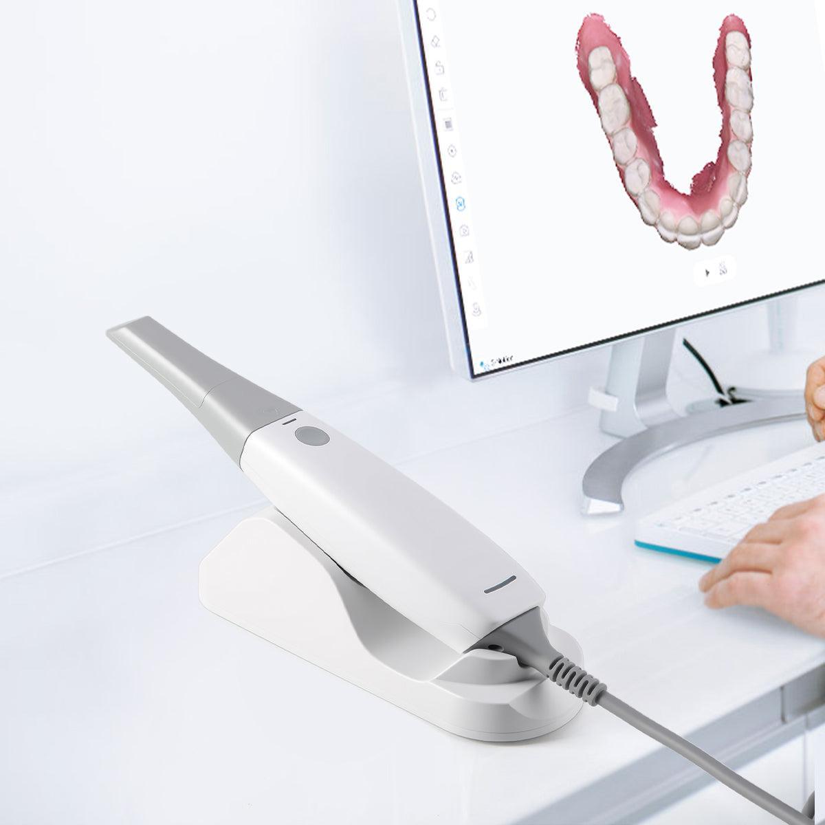 Intraoral scanner – Artem Dental Lab