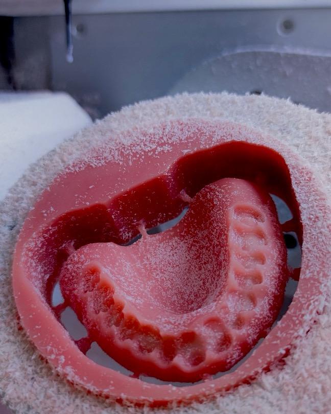 Avtagbar protetik – detalj