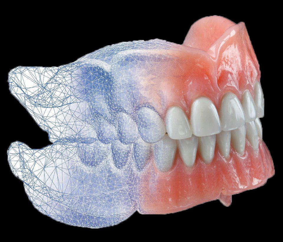 Avtagbar Protetik – Artem Dental Lab