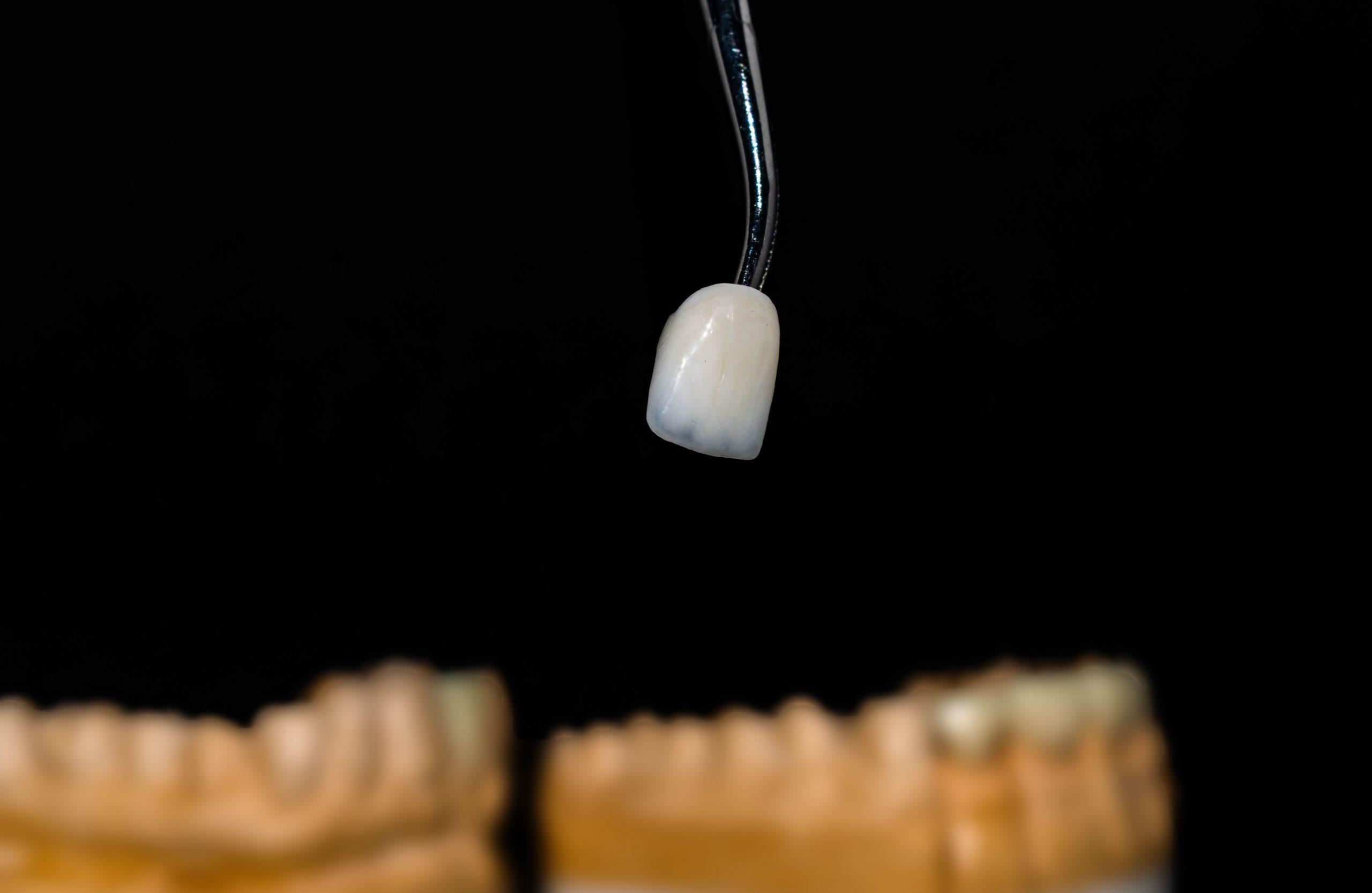 Kronor och broar – detalj